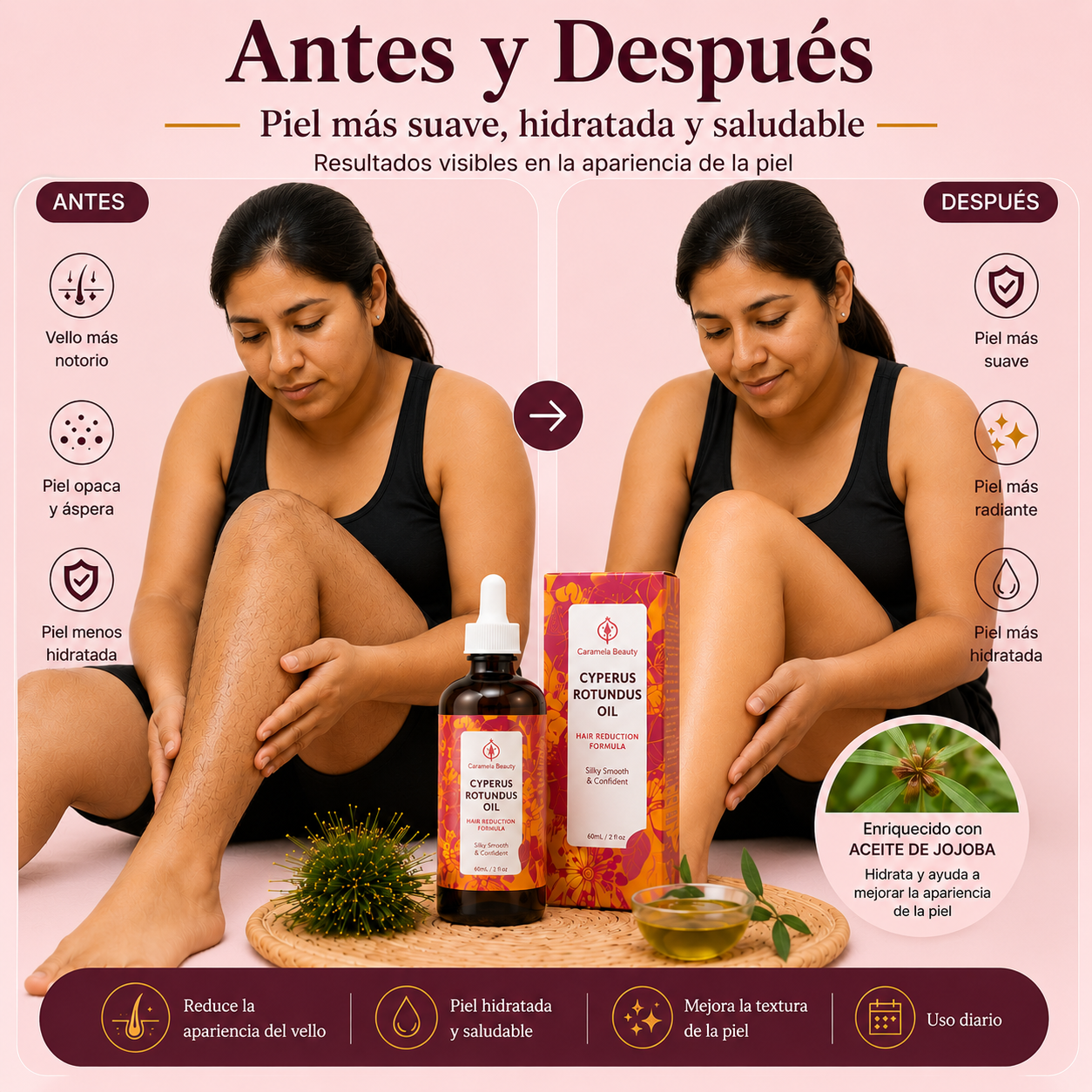 Despídete de la depilación constante.
