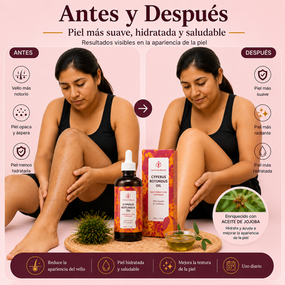 Despídete de la depilación constante.