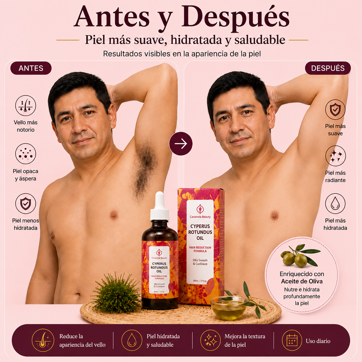 Despídete de la depilación constante.